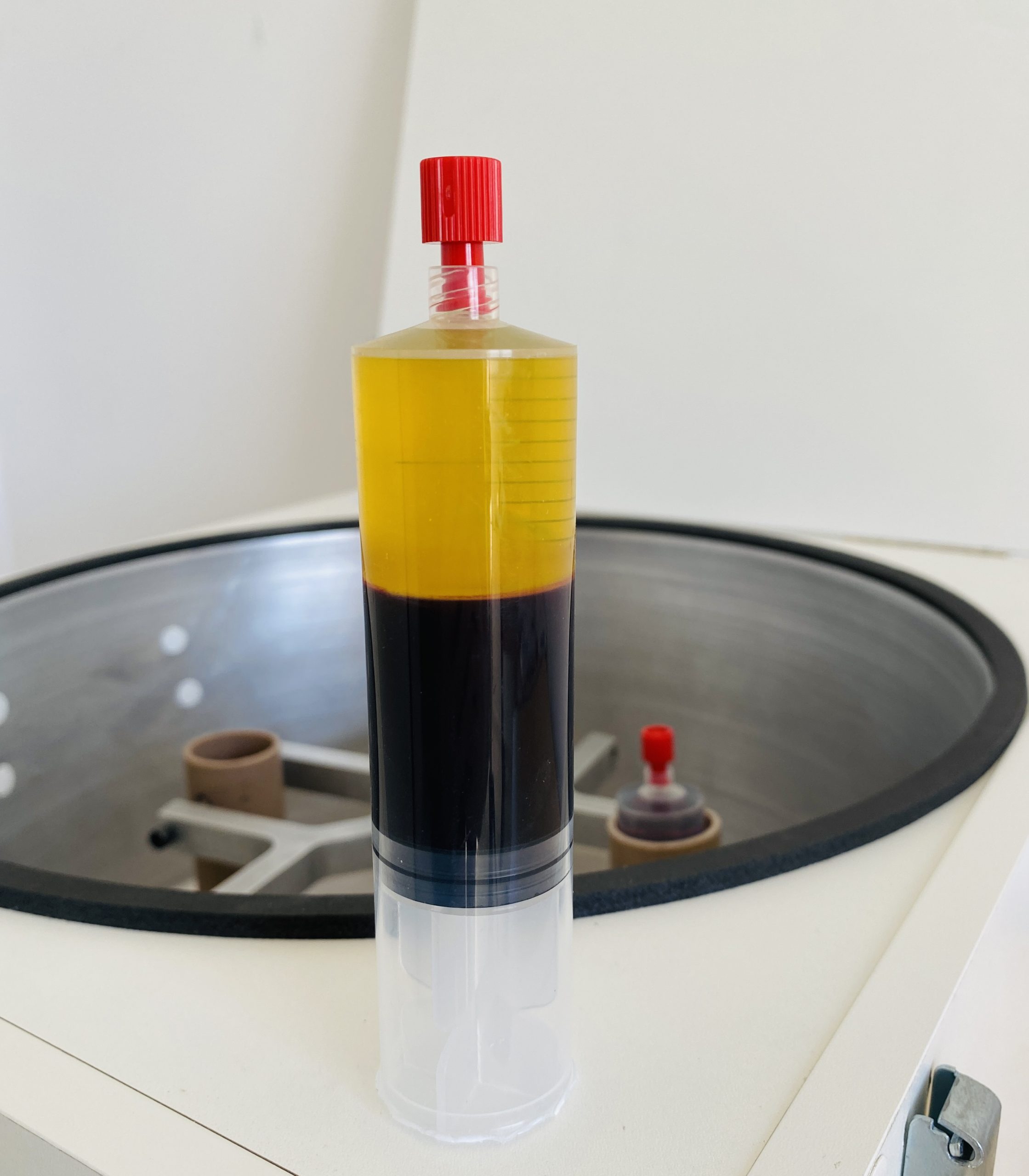 Welcome to DIYPRP: A New Standard for Autologous Platelet Therapy